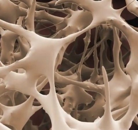 Trabecular bone