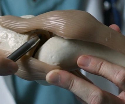An anatomical knee model