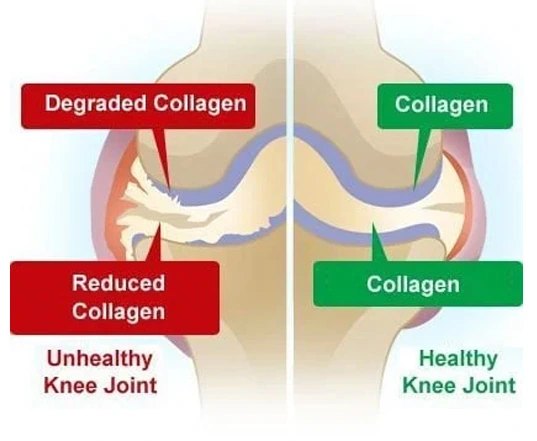Degraded against healthy collagen
